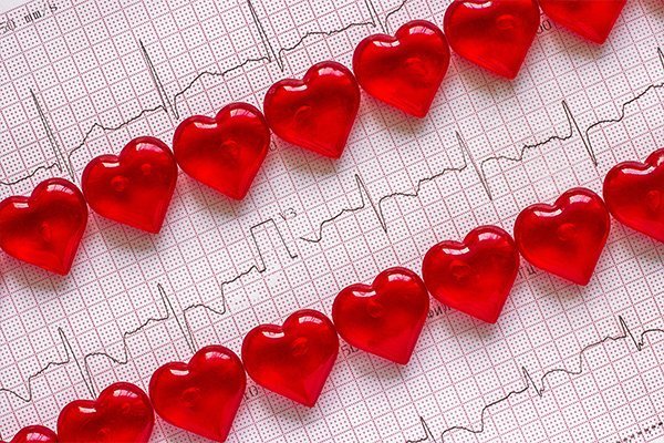 How Is a Heart Attack Different in Men and Women?